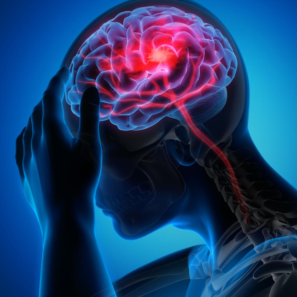 El Centro de Neurociencias y Manejo de Stroke del Sistema de Salud Menonita localizado en el Hospital Menonita Caguas integró el uso de RapidAI, una plataforma cuyos algoritmos de inteligencia artificial que evalúa el flujo sanguíneo del cerebro en pacientes que han experimentado un accidente cerebrovascular ("stroke").