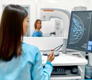 La mamografía consiste en una radiografía de los senos para detectar signos de cáncer de mama.