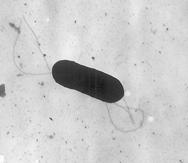 Esta imagen tomada con un microscopio electrónico y facilitada por los Centros para el Control y la Prevención de Enfermedades muestra una bacteria Listeria monocytogenes que causa la listeriosis.