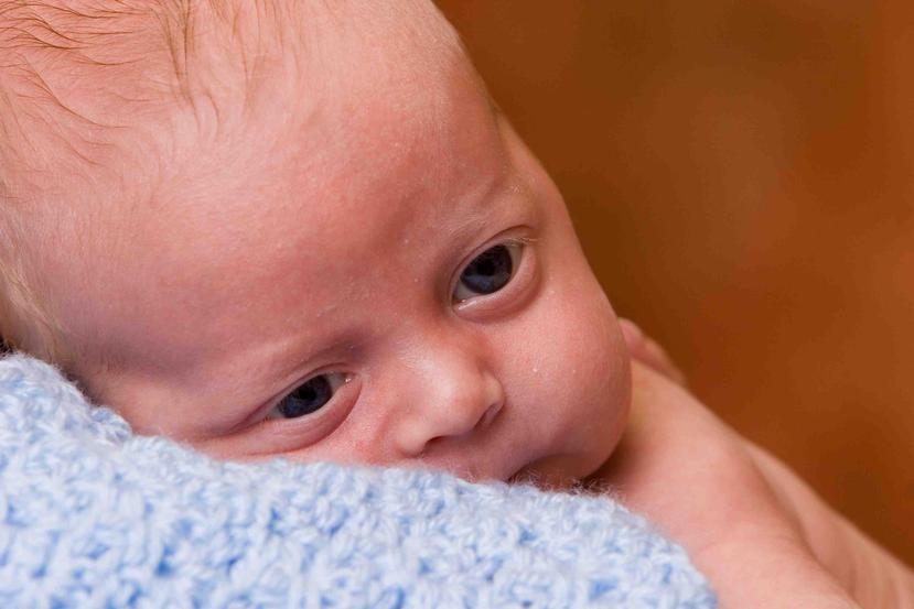 El diagnóstico se hace midiendo la cantidad de tiroxina (T4) y tireotropina TSH en sangre del bebé entre las 24 y las 36 horas de nacido. (Foto: Shutterstock.com)