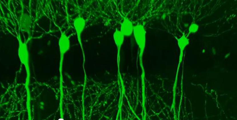 La proteína TAU está dentro de las neuronas y es la encargada de 'limpiar' las células cerebrales de proteínas tóxicas o no deseadas. (GFR Media)