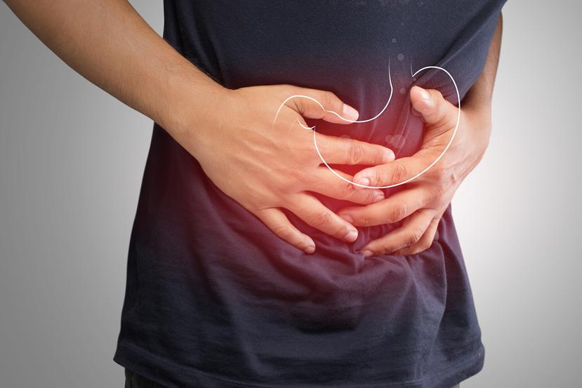 La acidez recurrente puede resultar en complicaciones más graves y hasta en cáncer gastrointestinal. (Shutterstock)