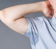 La hiperhidrosis afecta principalmente a hombres, pero las mujeres se sienten más presionadas por el sudor. (Shutterstock)