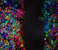 Células de cáncer de páncreas durante un proceso de migración celular. Imagen cedida por el Instituto de Tecnologías Físicas y de la Información Leonardo Torres Quevedo (ITEFI) del Consejo Superior de Investigaciones Científicas.