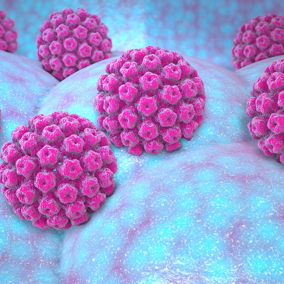 La infección persistente con tipos oncogénicos del virus del papiloma humano (VPH) puede causar seis tipos de cáncer.