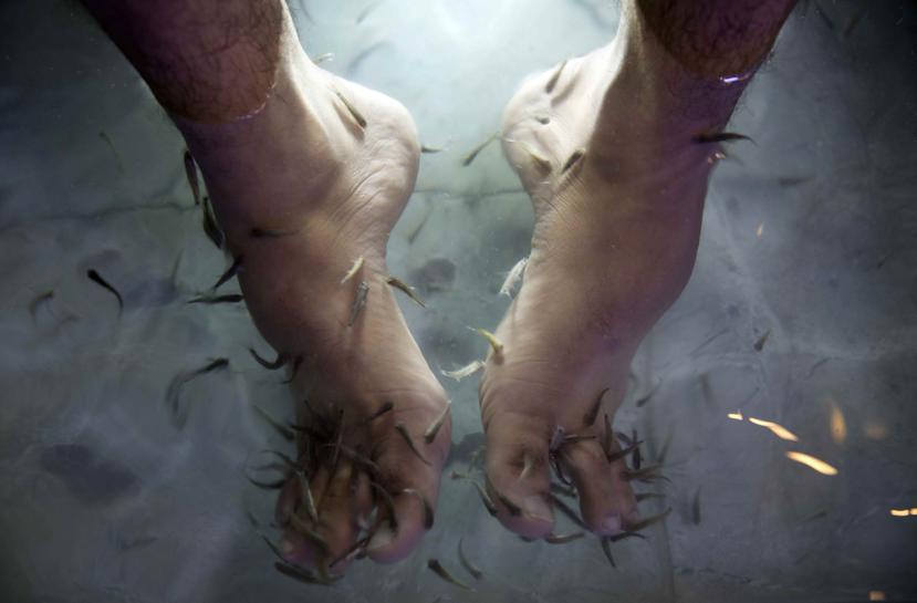 El pez, que se alimenta de las capas externas de la piel endurecida y muerta de los pies, ha sido utilizado durante años en spas como un método de limpieza.(AP)