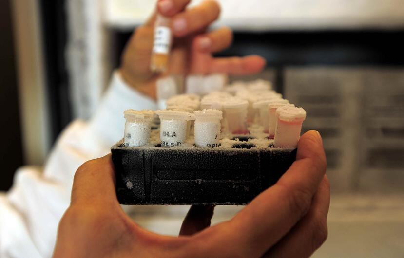 La prueba de la detección de sangre oculta en las heces fecales (Fecal Inmunochemical Testing o FIT) es una opción para la detección temprana y prevención del cáncer colorrectal. (Archivo/GFR)