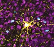Esta imagen microscópica provista por Pasca Lab/Stanford Medicine muestra un astrocito humano, centro amarillo, y células gliales humanas (azul) dentro del cerebro de una rata. (Pasca Lab/Stanford Medicine via AP)