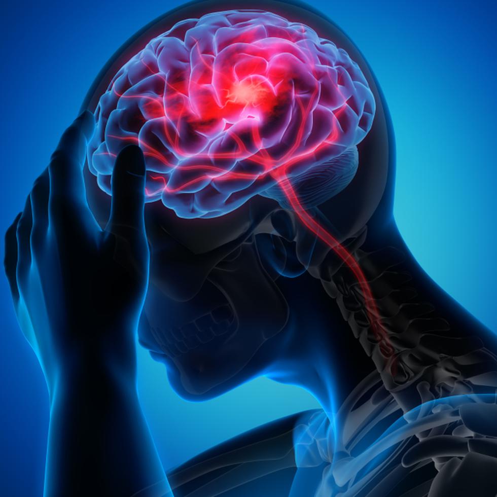 El Centro de Neurociencias y Manejo de Stroke del Sistema de Salud Menonita localizado en el Hospital Menonita Caguas integró el uso de RapidAI, una plataforma cuyos algoritmos de inteligencia artificial que evalúa el flujo sanguíneo del cerebro en pacientes que han experimentado un accidente cerebrovascular ("stroke").