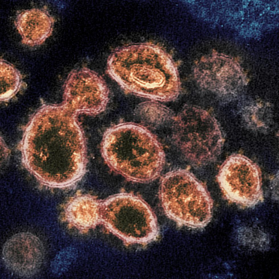 El SARS-CoV-2 es el coronavirus que causa el COVID-19, y a más de tres años de declararse la pandemia, aún se desconocen muchos de sus efectos en el organismo.
