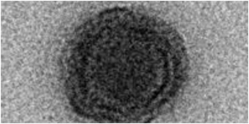 Una muestra del Yaravirus publicada por BIORXIV. (BIORXIV)