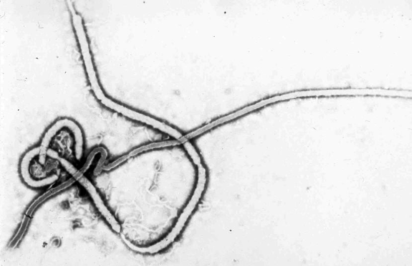 El virus del ébola se propaga por contacto directo con la sangre o fluidos corporales del paciente. (AP)