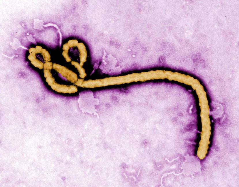 La epidemia de ébola en África occidenta ha infectado a casi 27,000 personas de las cuales más de 11,000 han muerto.