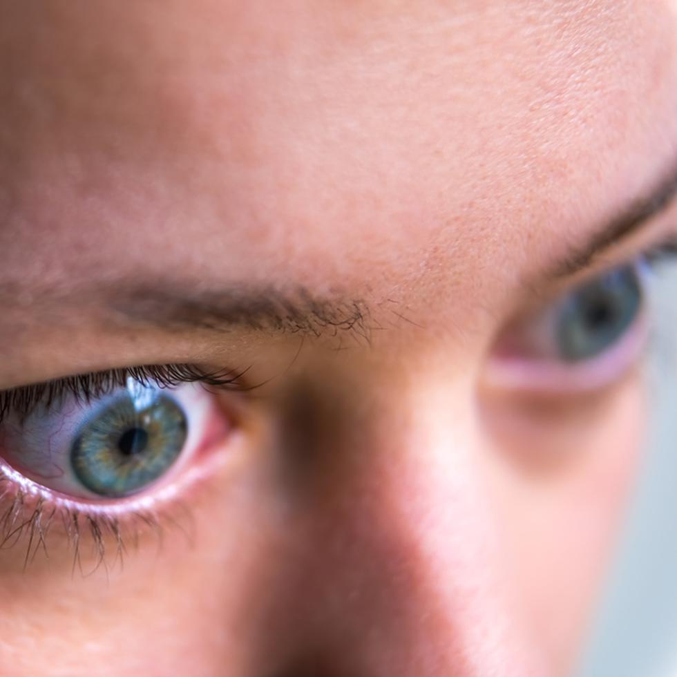 Varios factores pueden aumentar el riesgo de desarrollar enfermedad tiroidea de los ojos en ciertos pacientes, entre los que se encuentran: el factor genético, su género, una edad avanzada y altos niveles de estrés.
