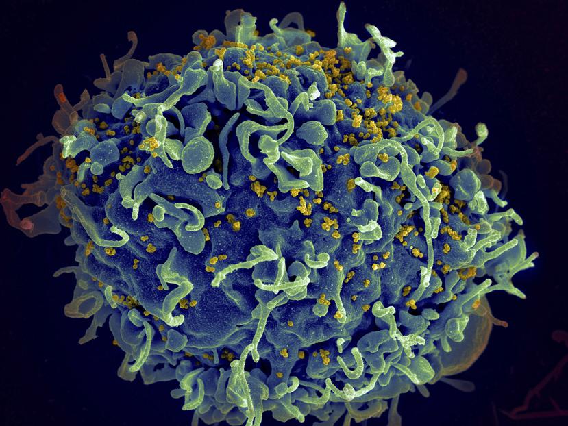 En esta imagen microscópica coloreada de archivo, distribuida por los Institutos Nacionales de Salud de Estados Unidos, se muestra una célula T humana, de color azul, atacada por el VIH (en amarillo), el virus que causa el sida.