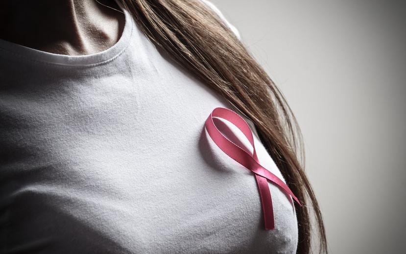 El cáncer de seno es uno de los más comunes en Puerto Rico. (Shutterstock)