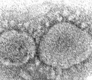 ARCHIVO - La imagen de microscopio electrónico de 2020 distribuida por los Centros de Control y Prevención de enfermedades muestra partículas de virus SARS-CoV-2, que causa COVID-19. La Cámara de Representantes votó por unanimidad el viernes 10 de marzo de 2023 hacer pública la información de los servicios de inteligencia estadounidenses sobre los orígenes del COVID-19, en una muestra de apoyo bipartidista en vísperas del tercer aniversario del inicio de la mortífera pandemia. (Hannah A. Bullock, Azaibi Tamin/CDC via AP, File)