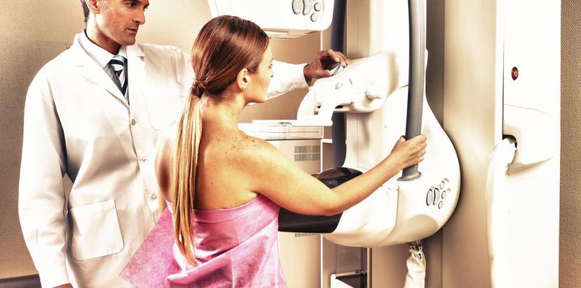 Mujeres de 50 a 75 deben practicarse una mamografía cada uno a dos años. (GFR Media)