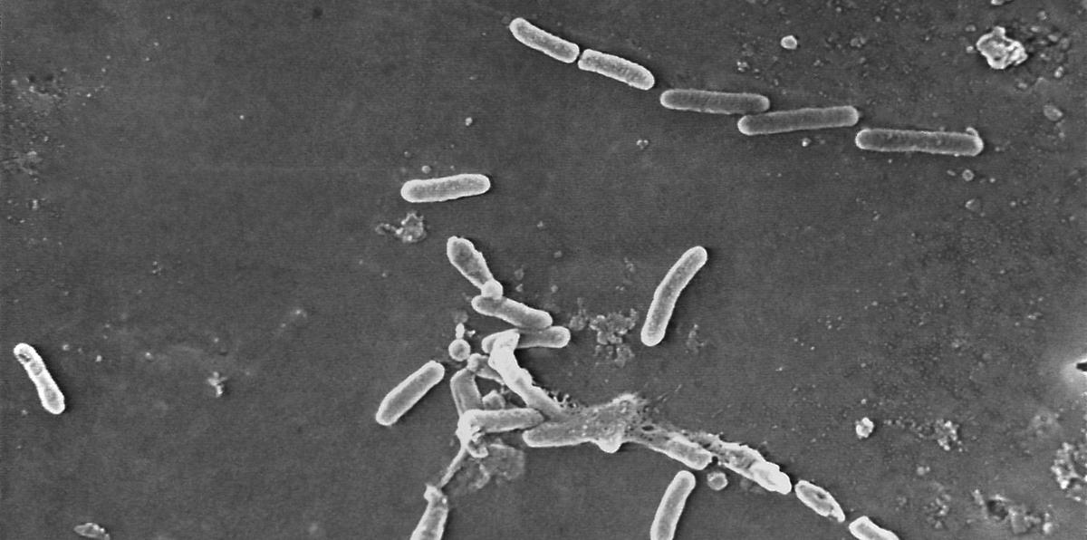 Esta imagen de microscopio electrónico, proporcionada por los Centros para el Control y la Prevención de Enfermedades, muestra la bacteria Pseudomonas aeruginosa.