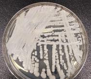 En esta fotografía de 2016 proporcionada por los Centros para el Control y la Prevención de Enfermedades de EEUU se muestra una cepa de la especie de hongo candida auris cultivada en una caja de petri en un laboratorio de la agencia.