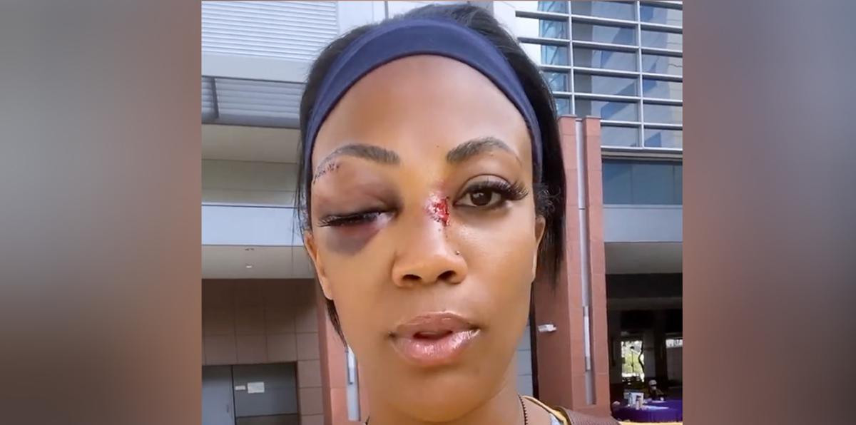 Medallista olímpica y exrefuerzo de las Pinkin de Corozal es brutalmente atacada