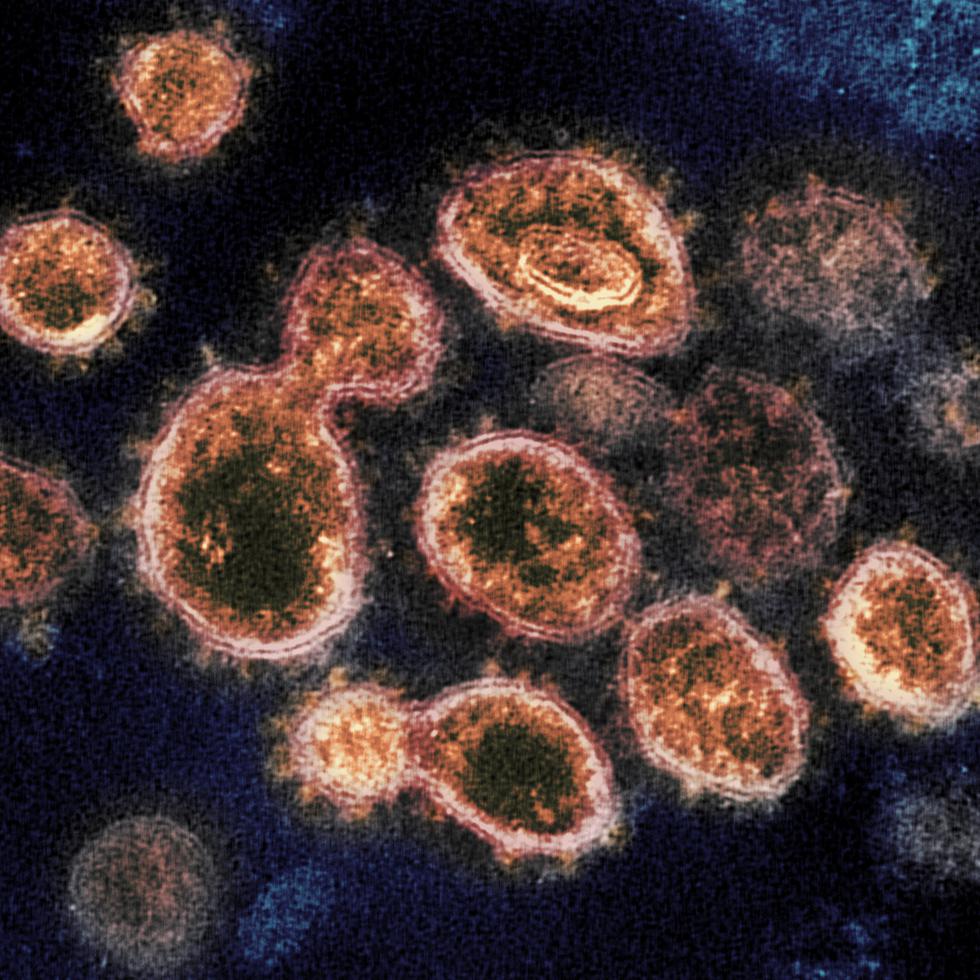 En esta imagen tomada con un microscopio electrónico en 2020, cortesía de los Laboratorios de las Montañas Rocosas de los Institutos Nacionales de la Salud, se ven partículas del virus SARS-CoV-2, causantes del COVID-19, aisladas de un paciente en Estados Unidos. (NIAID-RML vía AP)