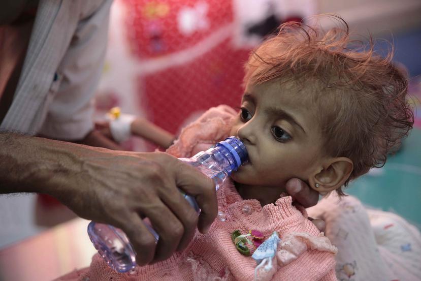En esta imagen de archivo, tomada el 27 de septiembre de 2018, un padre da agua a su hija desnutrida en un centro de alimentación de un hospital de Hodeida, Yemen. (AP Foto/Hani Mohammed)