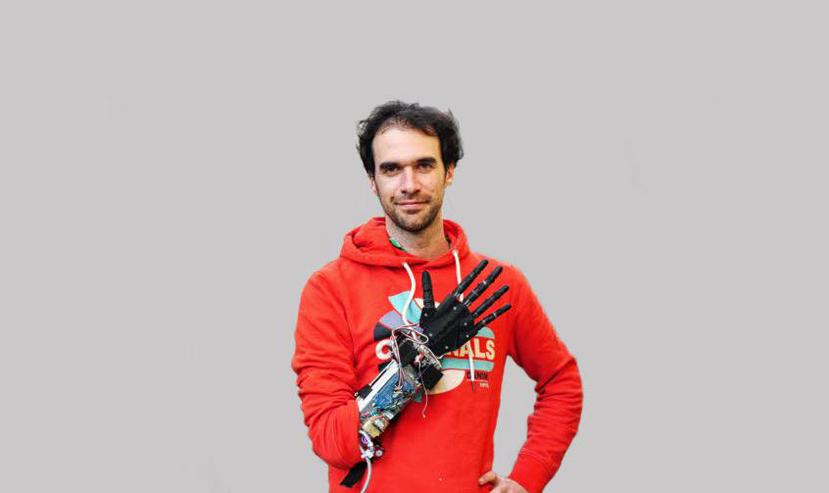 Huchet, quien perdió su mano en un accidente laboral, quiere ayudar a otras personas a obtener manos biónicas a bajo precio. (Fotocaptura)