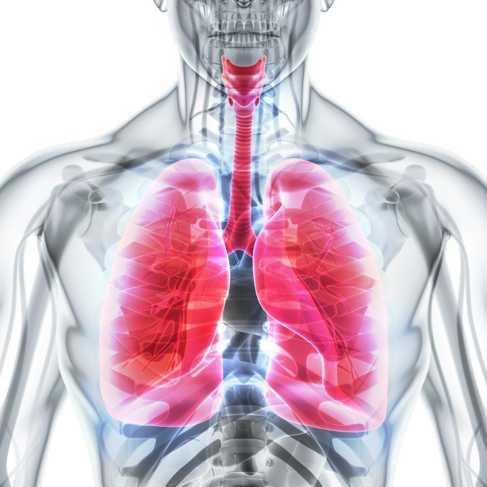 El cáncer de pulmón es la principal causa de muerte por cáncer en todo el mundo.