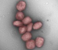 Partículas del virus de la viruela del mono teñidas de rojo en una fotografía facilitada por el Centro de Biología Molecular Severo Ochoa.