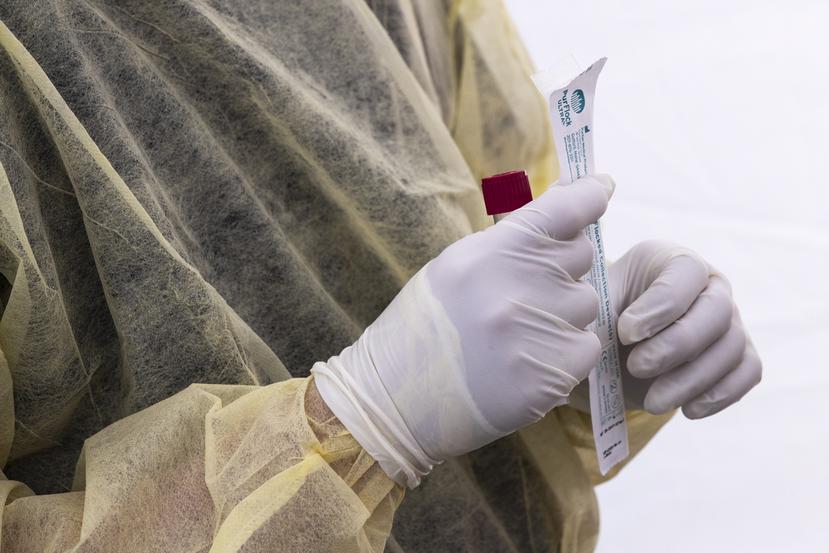 Un doctor sostiene una prueba de coronavirus.