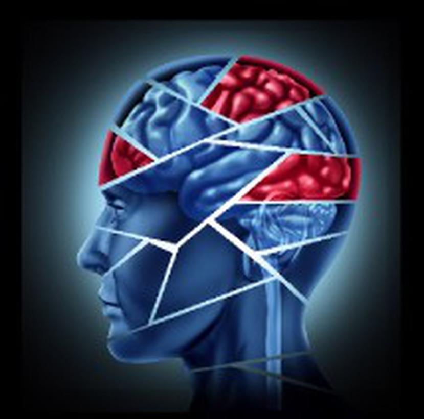 Cada día existe más evidencia que demuestra la capacidad del cerebro para recuperarse luego de un derrame cerebral.