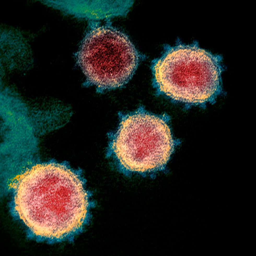 Imagen sin fecha tomada de microscopio electrónico y difundida por los Institutos Nacionales de Salud de EEUU en febrero de 2020 muestra el virus causante del COVID-19.