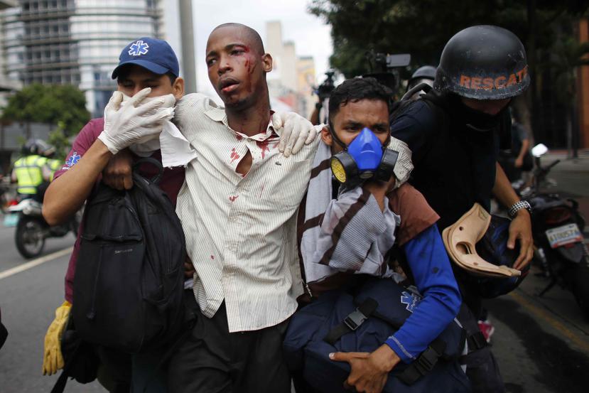 Las protestas en Venezuela han dejado 21 muertos, centenares de heridos y detenidos, de acuerdo con cifras oficiales. (AP)