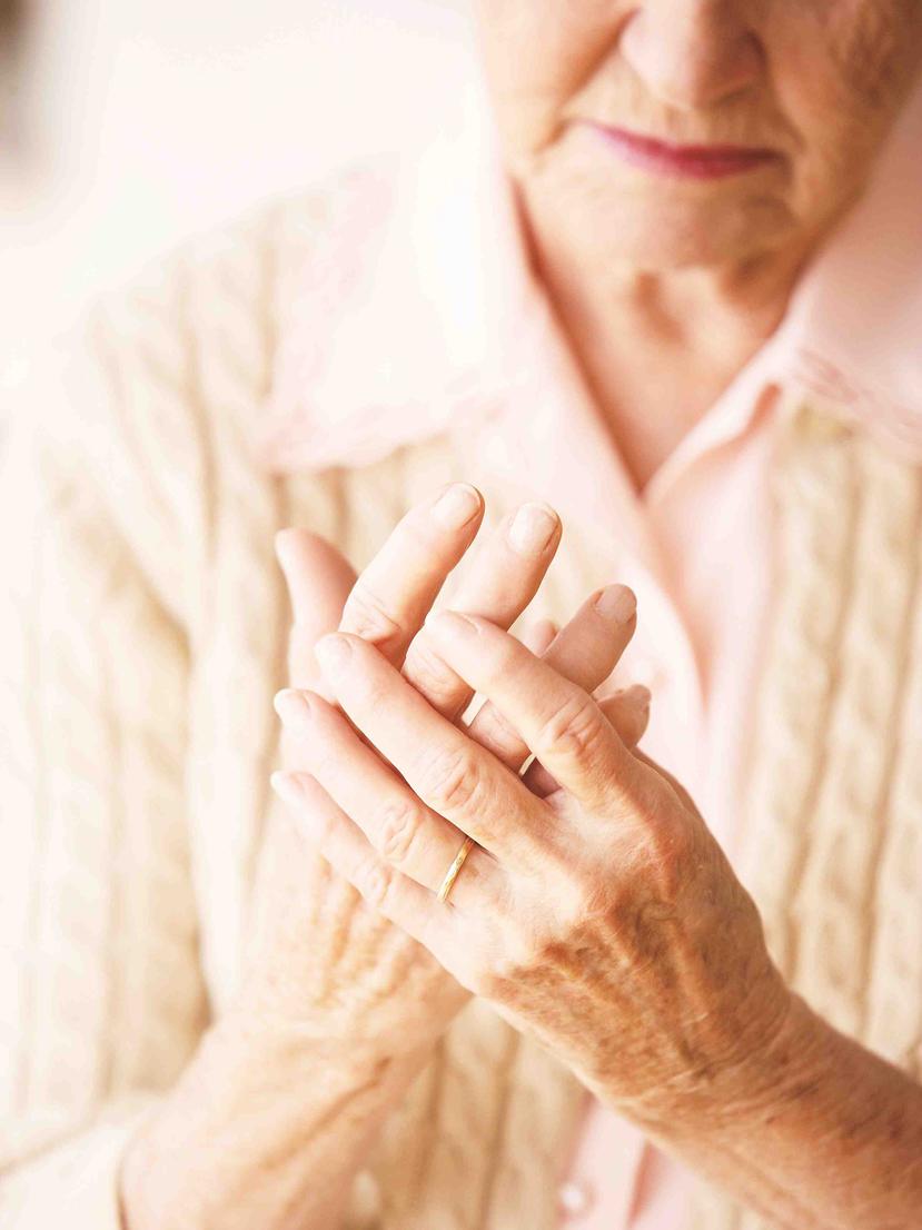 La artritis reumatoide se puede presentar a cualquier edad. (Archivo/ GFR Media)