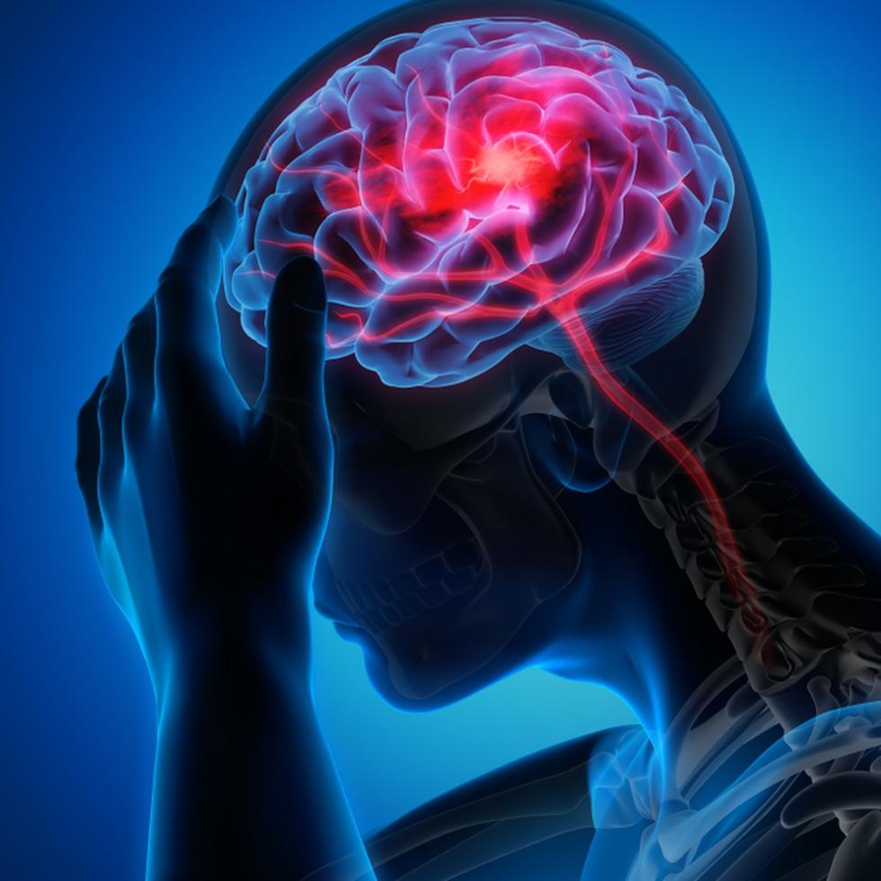 Cuidar el cerebro ayuda con la prevención de enfermedades neurológicas ya que reduce el riesgo de desarrollar afecciones cerebrales degenerativas, como la enfermedad de Alzheimer u otras formas de demencia.