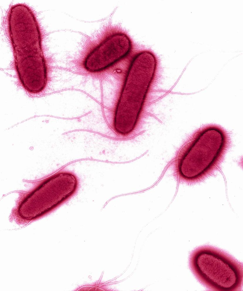 Los cultivos de E. coli y levadura se produjeron con normalidad. (GFR Media)