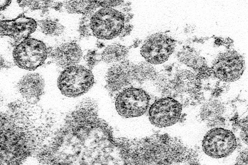 Foto del coronavirus tal como se ve en un microscopio. Foto tomada en el 2020 y facilitada por los Centros de Control y Prevención de Enfermedades de EEUU.