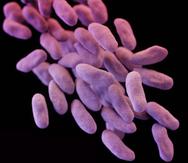 Siete personas están infectados con la superbacteria, mientras que otros dos murieron. (The Associated Press)