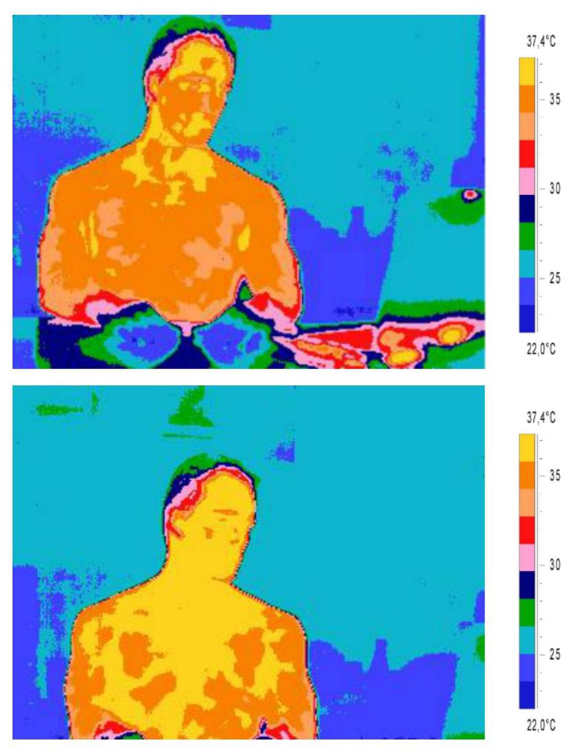 Un método basado en la termografía, permite determinar si una persona está enamorada a través de los cambios de temperatura que experimenta su cuerpo al contemplar la imagen de la persona amada.