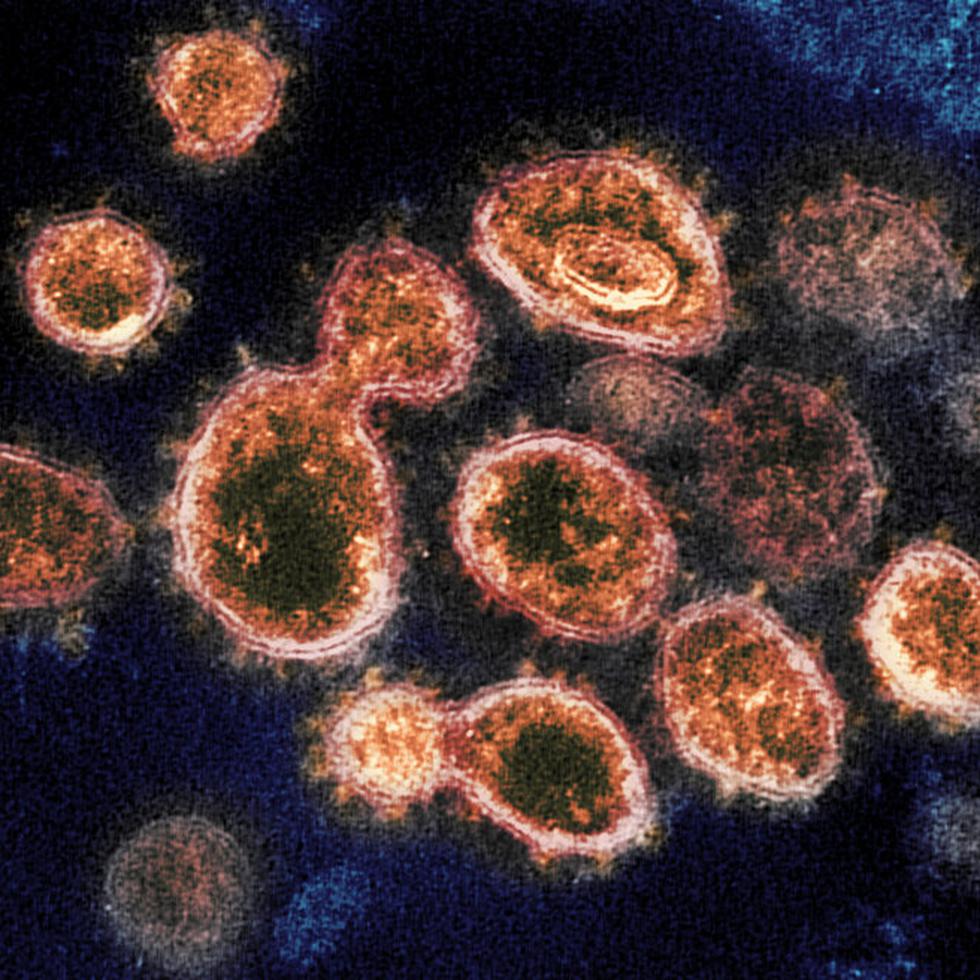 This 2020 electron microscope image provided by the National Institute of Allergy and Infectious Diseases - Rocky Mountain Laboratories shows SARS-CoV-2 virus particles which cause COVID-19, isolated from a patient in the U.S., emerging from the surface of cells cultured in a lab. According to two new studies released on Tuesday, Dec. 22, 2020, people who have antibodies from infection with the coronavirus seem less likely to get a second infection for several months and maybe longer.