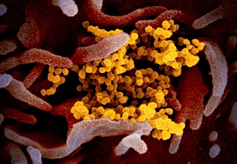 Imagen de un microscopio de electrones que muestra el nuevo coronavirus SARS-CoV-2 (amarillo), cultivado en un laboratorio, emergiendo de la superficie de las células (rosado). (NIAID-RML vía AP)