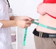La obesidad afecta la calidad de vida en la vejez y también la expectativa de vida. (Shutterstock)