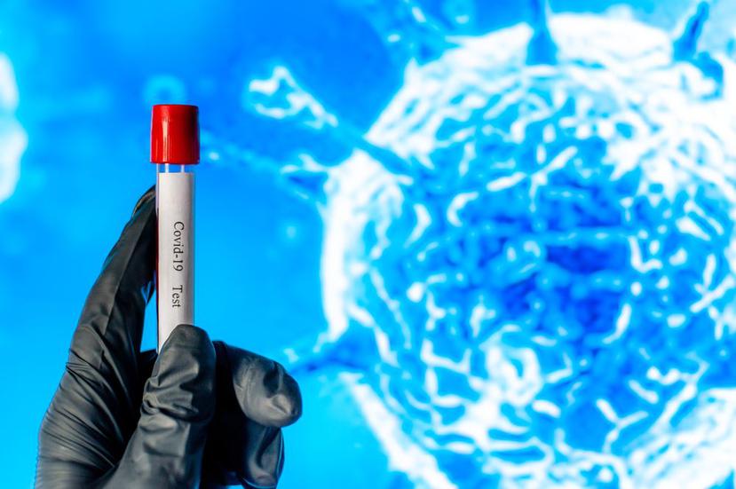 Un grupo de científicos australianos esperan probar en humanos una droga antiparasitaria para matar al coronavirus. (Shutterstock)