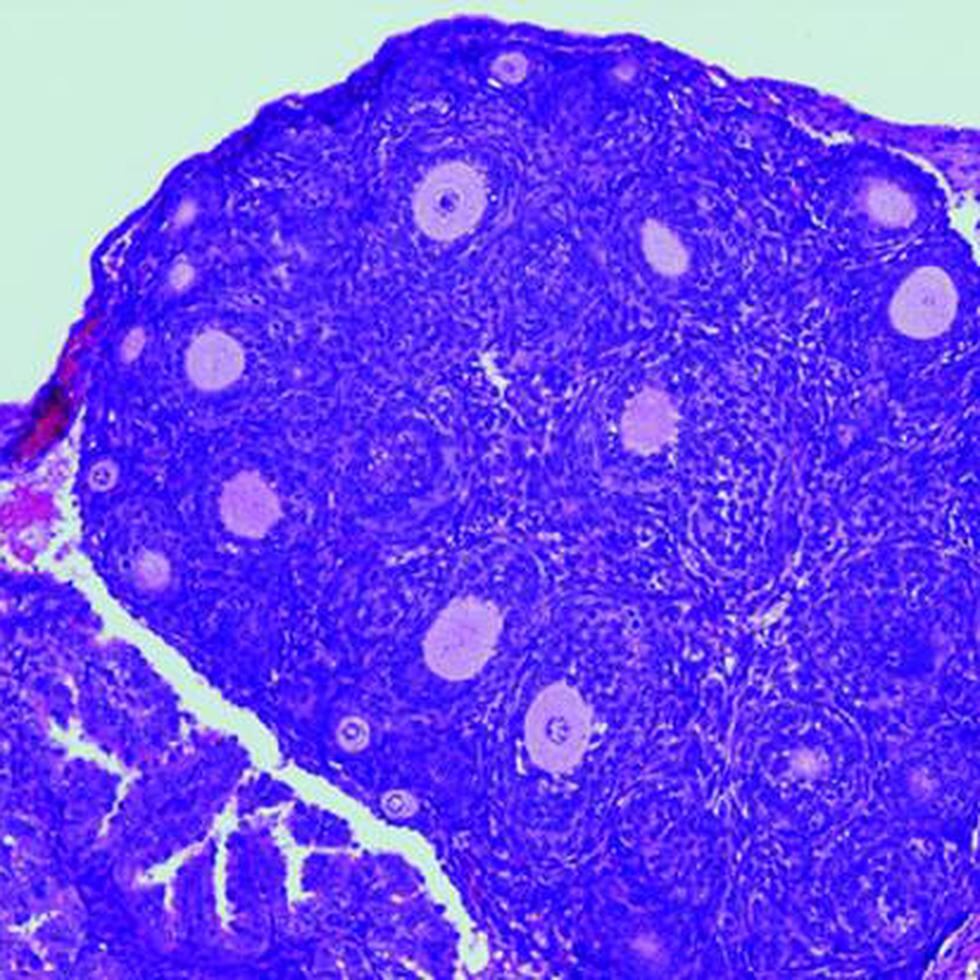 En la imagen se muestra la reducción en el número de folículos ováricos (causante de la insuficiencia ovárica prematura) en los ratones con la variante "humanizada" de una proteína. Imagen cedida por el Centro de Investigación del Cáncer (CSIC-USAL).