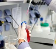 Imagen de archivo que muestra a una tecnóloga médica realizando pruebas en un laboratorio.