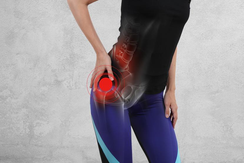 Entre las nuevas técnicas, el abordaje anterior de cadera es la intervención quirúrgica más popular. (Shutterstock)