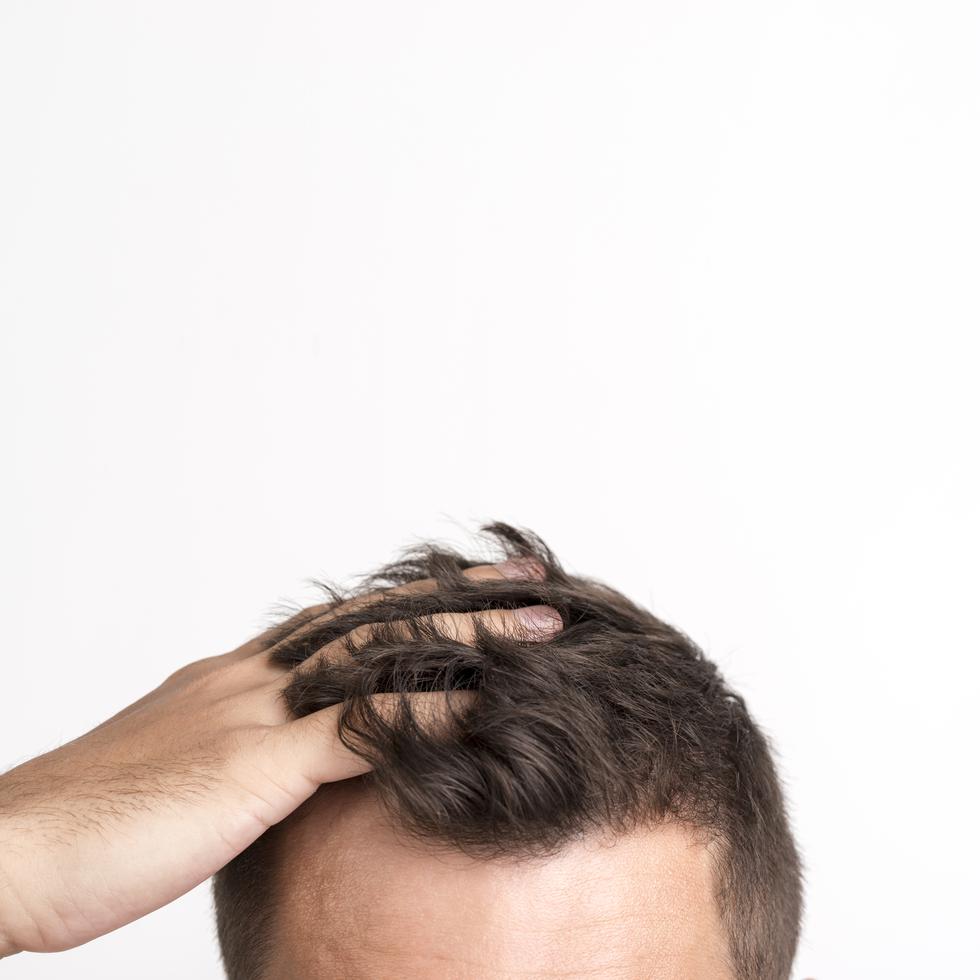 La razón biológica para alterar el ciclo de la caída del cabello no está del todo clara, pero podría estar asociada a una respuesta inteligente del cuerpo humano. (Freepik)