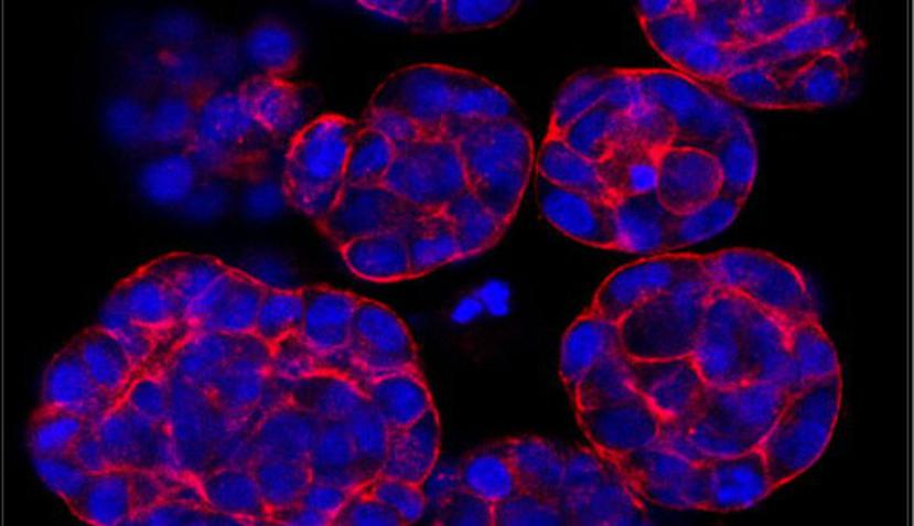 Investigadores suizos han descubierto que las células cancerosas encuentran agentes que los reciben para comunicar y tener un medio de transporte por todo el cuerpo. (EFE)
