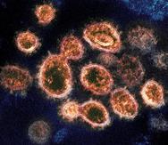 ARCHIVO - Esta imagen captada con un microscopio electrónico y proporcionada por el Instituto Nacional de Alergias y Enfermedades Infecciosas muestra partículas del virus SARS-CoV-2 que causan el COVID-19 aisladas de un enfermo en Estados Unidos. (NIAID-RML vía AP)